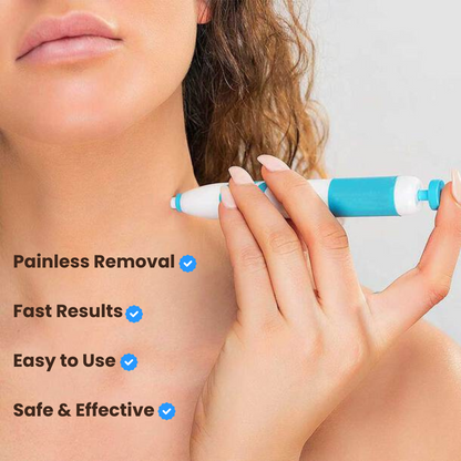 TagBuddy Kit - No More Skin TagsSkin